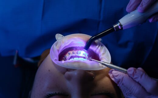Jak najlepiej dbać o zęby z aparatem ortodontycznym?